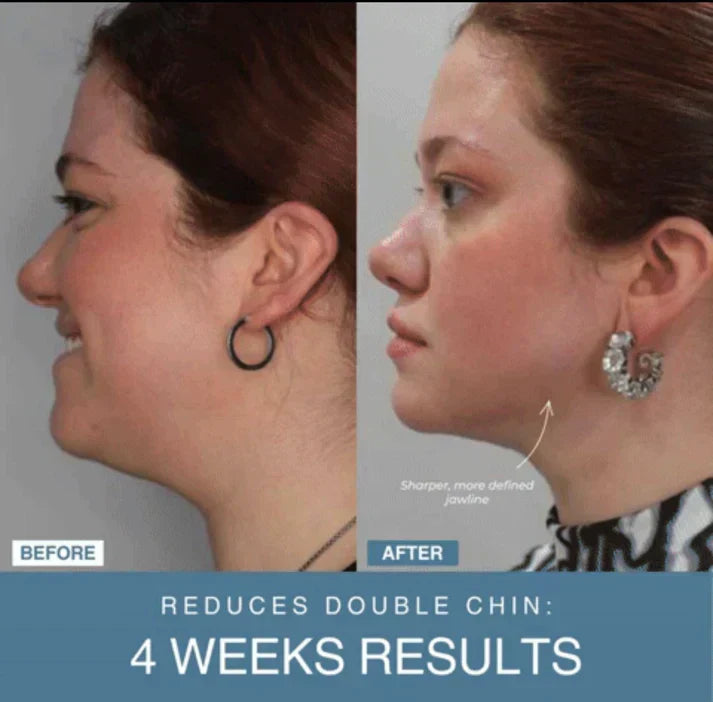 7-in-1 LED Anti-Aging/Wrinkle Apparatus
